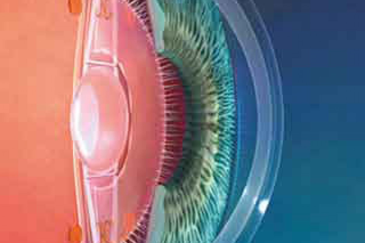Nuove lenti intraoculari per la presbiopia