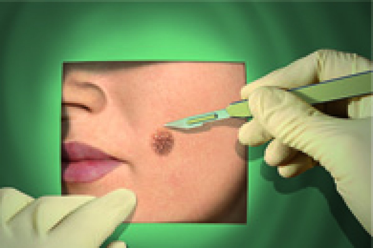 Gestione delle patologie dermatologiche invalidanti: efficacia per i pazienti, efficienza per il sistema sanitario