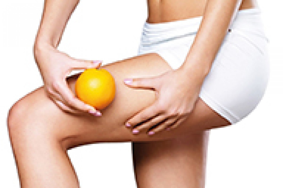 Cellulite: una dieta drastica può peggiorarla