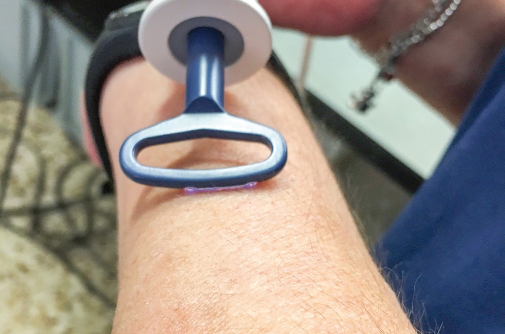 plasma