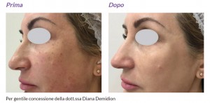 primaedopolumenis